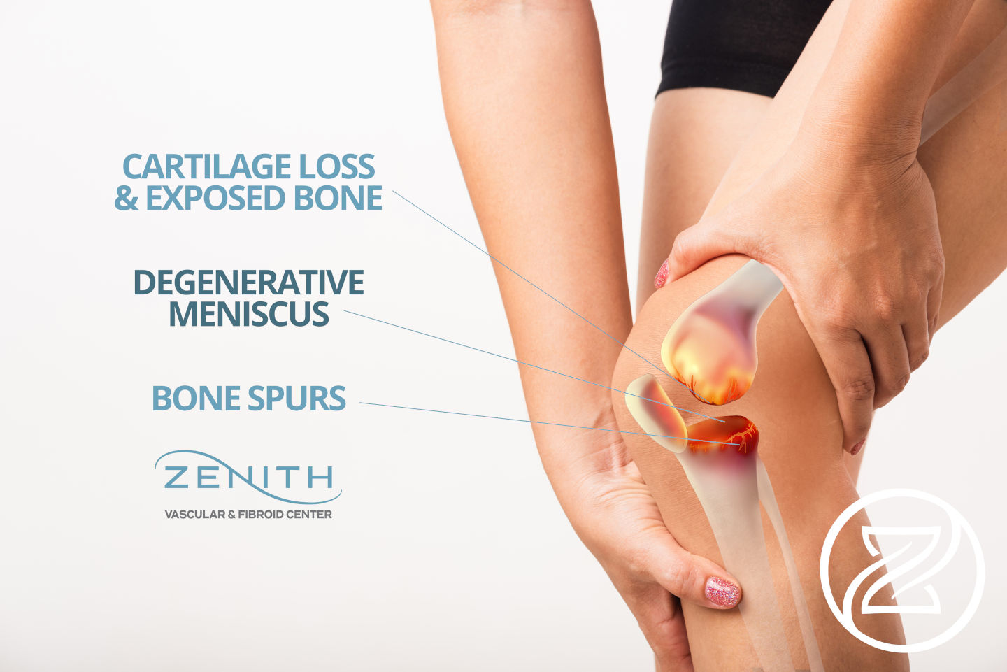 diagram of reasons for knee pain diagram of reasons for knee pain