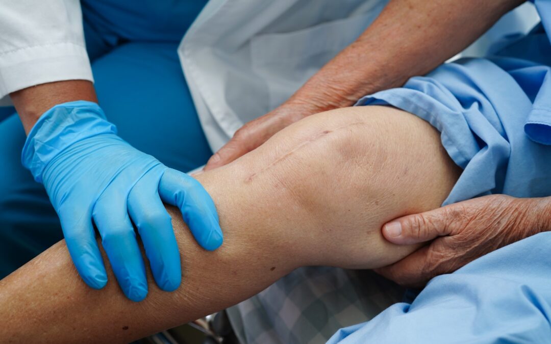 Comparing GAE to Traditional Knee Replacement and Injection Therapies