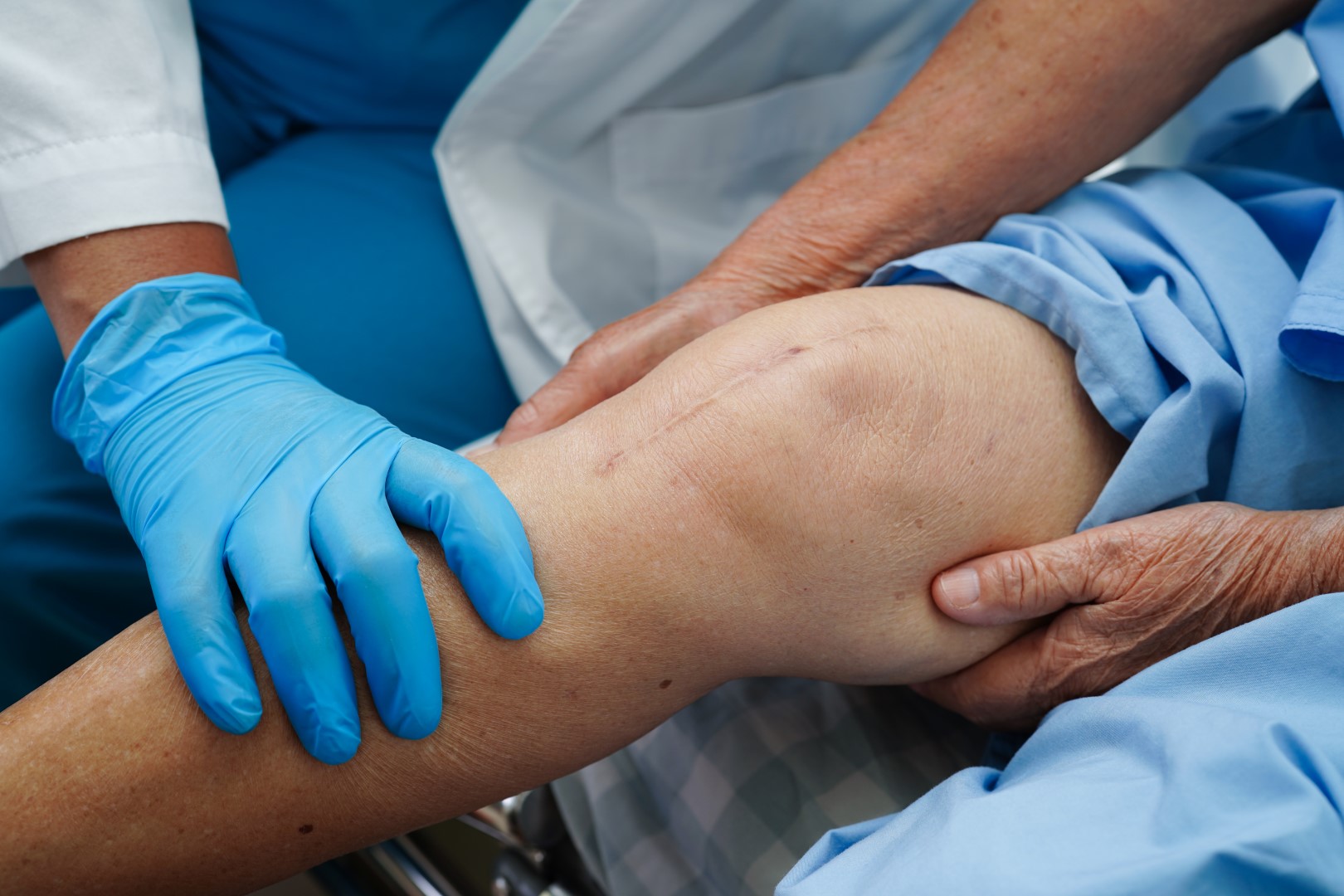 Treatment for Knee Pain Without Surgery