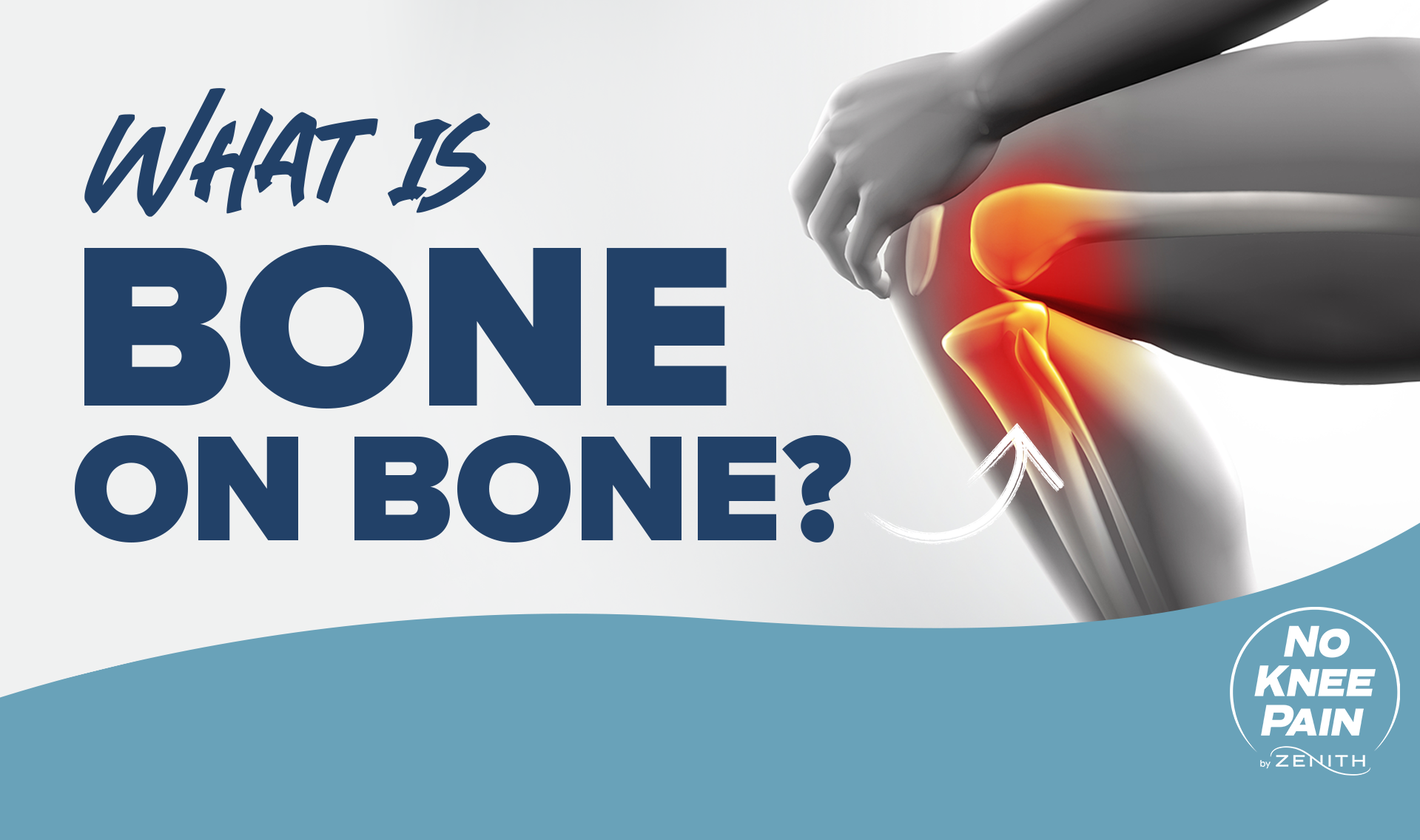What Is Bone On Bone zenith memphis